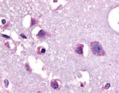 Immunohistochemistry-Paraffin: CRHR1/CRF1 Antibody - BSA Free [NLS1778]