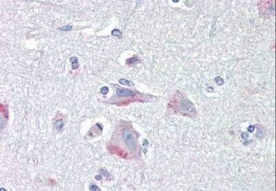 Immunohistochemistry-Paraffin: CRHR1/CRF1 Antibody [NB100-57078]