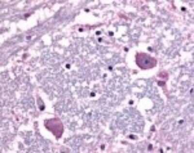 Immunohistochemistry-Paraffin: CRHR1/CRF1 Antibody - BSA Free [NLS1779]