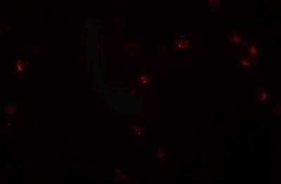 Immunocytochemistry/ Immunofluorescence: CRIM1 Antibody - BSA Free [NBP2-81803]
