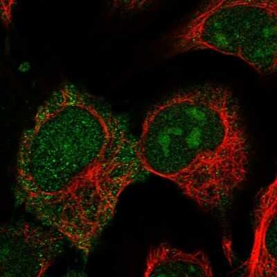 Immunocytochemistry/ Immunofluorescence: CRIP2 Antibody [NBP1-84379]