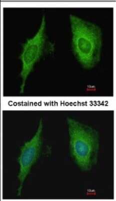 Immunocytochemistry/ Immunofluorescence: CRIP2 Antibody [NBP2-16012]