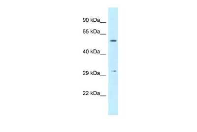 Western Blot: CRISPLD1 Antibody [NBP2-84725]