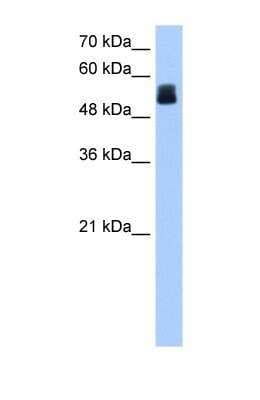 Western Blot: CRISPLD2 Antibody [NBP1-69620]