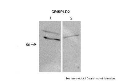 Western Blot: CRISPLD2 Antibody [NBP1-69620]