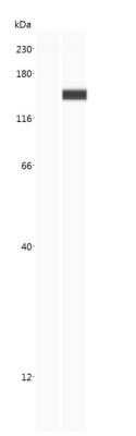 Simple Western: CRISPR-Cas9 Antibody (6G12)C-terminusAzide and BSA Free [NBP2-80680]