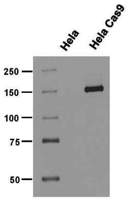 Western Blot: CRISPR-Cas9 Antibody (6G12)C-terminusAzide and BSA Free [NBP2-80680]