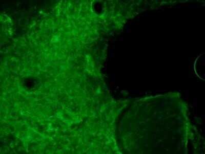 Immunohistochemistry-Frozen: CRISPR-Cas9 Antibody (7A9-3A3) - N-Terminus - Azide and BSA Free [NBP2-80679]