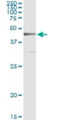 Immunoprecipitation: CRLF1 Antibody (4F4) [H00009244-M01]