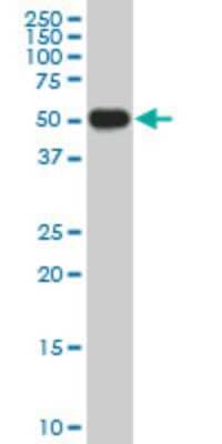 Western Blot: CRLF1 Antibody (5C2) [H00009244-M02]