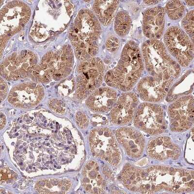 Immunohistochemistry-Paraffin: CRLF1 Antibody [NBP1-85605]