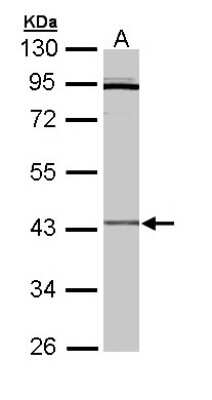 Western Blot: CRLF1 Antibody [NBP1-32792]