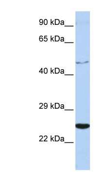 Western Blot: CRLF1 Antibody [NBP1-58328]