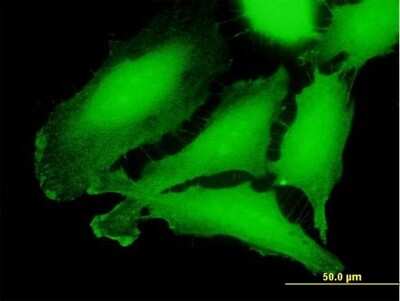 Immunocytochemistry/ Immunofluorescence: CRLF3 Antibody [H00051379-B01P]
