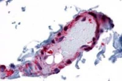 Immunohistochemistry-Paraffin: CRLR Antibody - BSA Free [NLS6731]