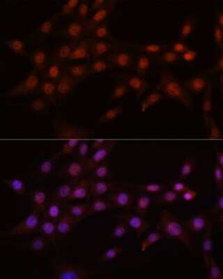 Immunocytochemistry/ Immunofluorescence: CRM1 Antibody (1J0L10) [NBP3-15823]