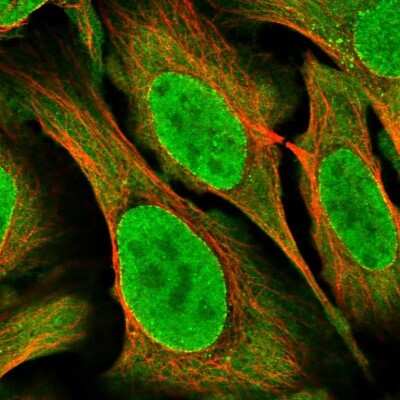 Immunocytochemistry/ Immunofluorescence: CRM1 Antibody [NBP2-33381]