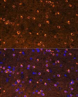 Immunohistochemistry: CRMP2 Antibody (0A1T1) [NBP3-16406]