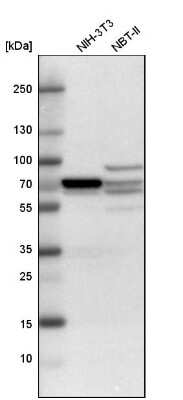 Western Blot: CRMP2 Antibody [NBP1-85448]