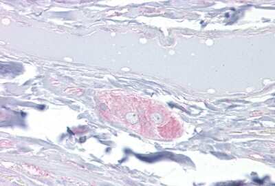 Immunohistochemistry: CRMP4 Antibody [NBP2-87213]