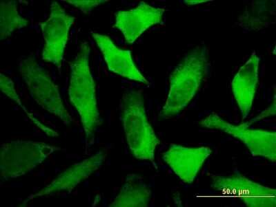 Immunocytochemistry/ Immunofluorescence: CRMP5 Antibody (2D10) [H00056896-M04]