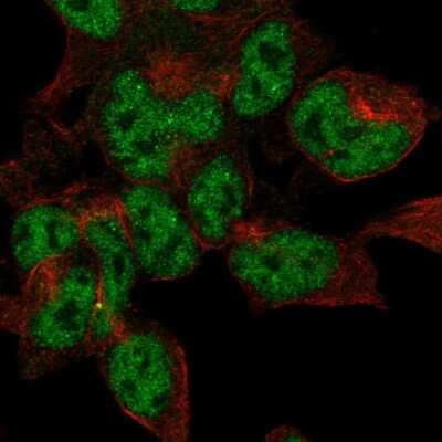 Immunocytochemistry/ Immunofluorescence: CRMP5 Antibody [NBP2-55982]