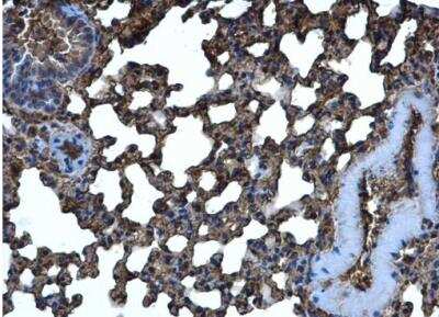 Immunohistochemistry-Paraffin: CRMP5 Antibody [NBP1-33419]