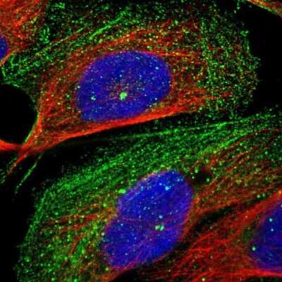 Immunocytochemistry/ Immunofluorescence: CROCC Antibody [NBP1-80820]