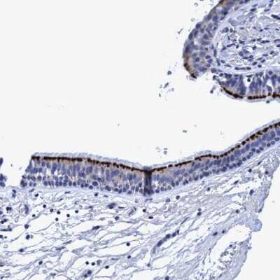 Immunohistochemistry-Paraffin: CROCC Antibody [NBP1-80820]