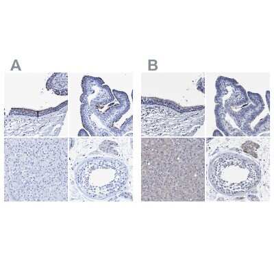 Immunohistochemistry-Paraffin: CROCC Antibody [NBP1-80820]