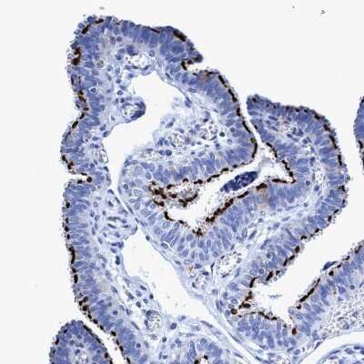 Immunohistochemistry-Paraffin: CROCC Antibody [NBP1-80820]