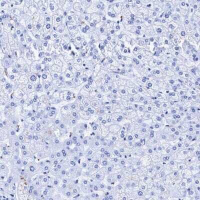 Immunohistochemistry-Paraffin: CROCC Antibody [NBP1-80820]