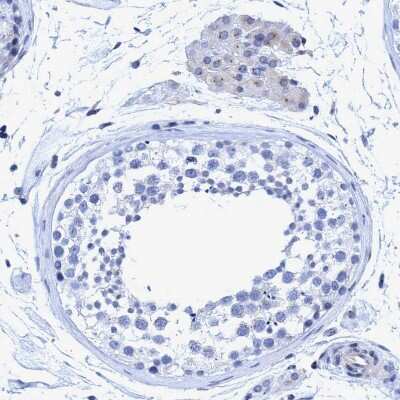 Immunohistochemistry-Paraffin: CROCC Antibody [NBP1-80820]