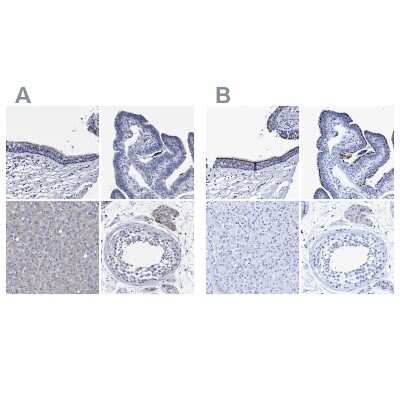 Immunohistochemistry-Paraffin: CROCC Antibody [NBP1-80821]