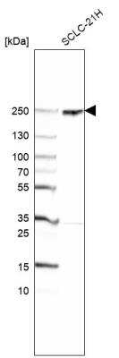 Western Blot: CROCC Antibody [NBP1-80820]