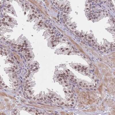 Immunohistochemistry-Paraffin: CROCC2 Antibody [NBP2-14651]