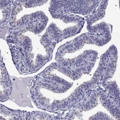 Immunohistochemistry-Paraffin: CROCC2 Antibody [NBP2-14651]