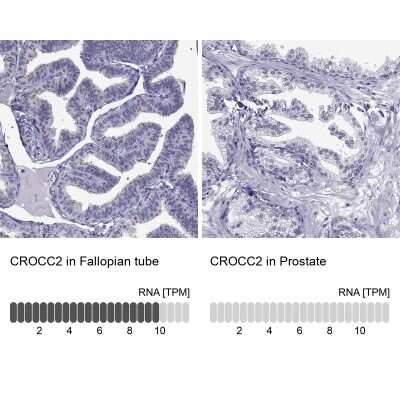 Immunohistochemistry-Paraffin: CROCC2 Antibody [NBP2-14651]