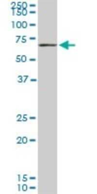 Western Blot: CROT Antibody (1A6) [H00054677-M01]
