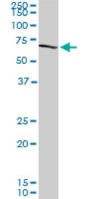Western Blot: CROT Antibody (1A6) [H00054677-M01]