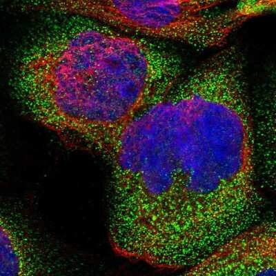 Immunocytochemistry/ Immunofluorescence: CROT Antibody [NBP1-85501]