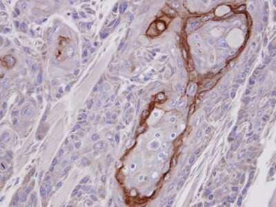 Immunohistochemistry-Paraffin: CROT Antibody [NBP1-31441]
