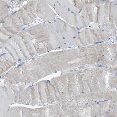 Immunohistochemistry-Paraffin: CROT Antibody [NBP1-85502]