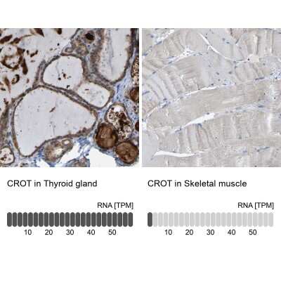 Immunohistochemistry-Paraffin: CROT Antibody [NBP1-85502]