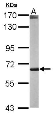 Western Blot: CROT Antibody [NBP1-31441]