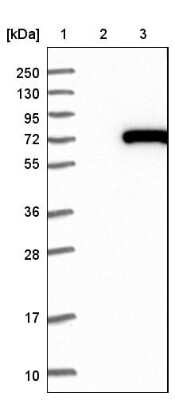 Western Blot: CROT Antibody [NBP1-85502]