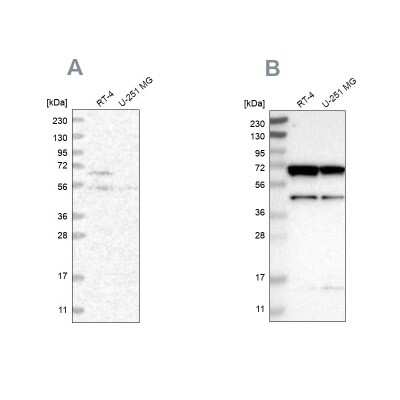 Western Blot: CROT Antibody [NBP1-85502]
