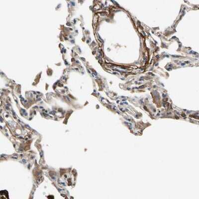 Immunohistochemistry-Paraffin: CRTAC1 Antibody [NBP1-88864]
