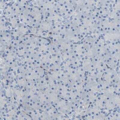 Immunohistochemistry-Paraffin: CRTAC1 Antibody [NBP1-88864]