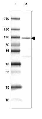 Western Blot: CRTAC1 Antibody [NBP1-88864]
